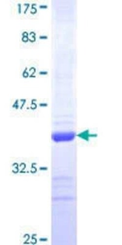 Novus Biologicals Recombinant Human COL14A1 GST (N-Term) Protein 25 &mu;g | Buy Online | Novus Biologicals&trade; | Fisher Scientific