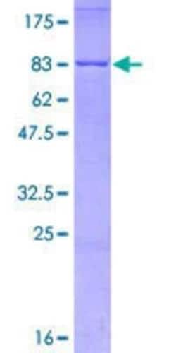 Novus Biologicals Recombinant Human LXR beta/NR1H2 GST (N-Term) Protein 2 &mu;g | Buy Online | Novus Biologicals&trade; | Fisher Scientific