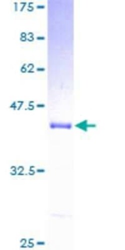 Novus Biologicals Recombinant Human UQCRB GST (N-Term) Protein 10 &mu;g | Buy Online | Novus Biologicals&trade; | Fisher Scientific