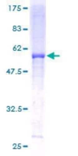 Novus Biologicals Recombinant Human UQCRFS1 GST (N-Term) Protein 10 &mu;g | Buy Online | Novus Biologicals&trade; | Fisher Scientific