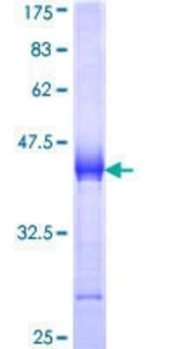 Novus Biologicals Recombinant Human Utrophin GST (N-Term) Protein 25 &mu;g | Buy Online | Novus Biologicals&trade; | Fisher Scientific