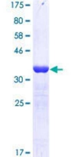 Novus Biologicals Recombinant Human KDM6A GST (N-Term) Protein 25 &mu;g | Buy Online | Novus Biologicals&trade; | Fisher Scientific