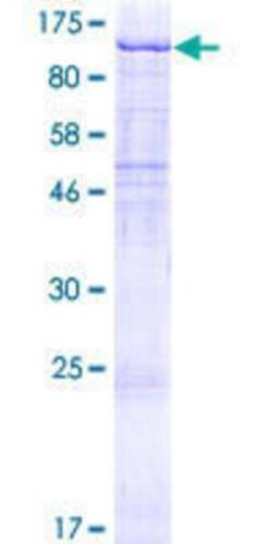 Novus Biologicals Recombinant Human UVRAG GST (N-Term) Protein 2 &mu;g | Buy Online | Novus Biologicals&trade; | Fisher Scientific