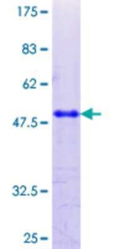 Novus Biologicals Recombinant Human UVRAG GST (N-Term) Protein 10 &mu;g | Buy Online | Novus Biologicals&trade; | Fisher Scientific
