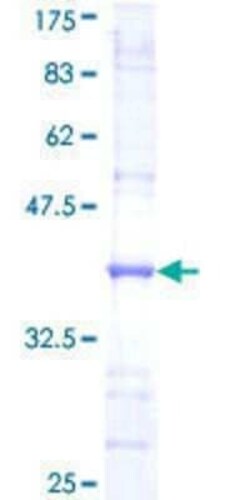 Novus Biologicals Recombinant Human VDAC1 GST (N-Term) Protein 10 &mu;g | Buy Online | Novus Biologicals&trade; | Fisher Scientific