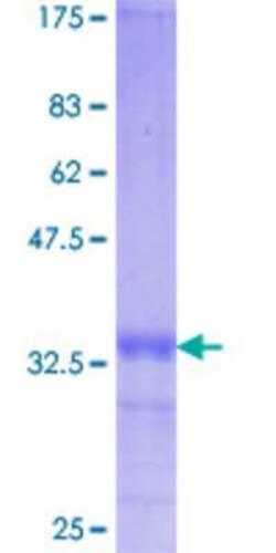 Novus Biologicals Recombinant Human VDAC1 GST (N-Term) Protein 25 &mu;g | Buy Online | Novus Biologicals&trade; | Fisher Scientific