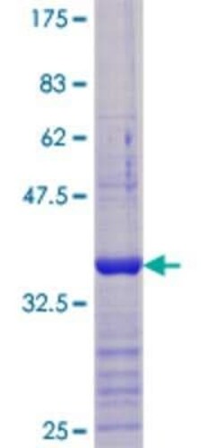 Novus Biologicals Recombinant Human VDAC1 GST (N-Term) Protein 10 &mu;g | Buy Online | Novus Biologicals&trade; | Fisher Scientific