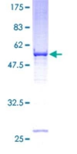 Novus Biologicals Recombinant Human VDAC2 GST (N-Term) Protein 2 &mu;g | Buy Online | Novus Biologicals&trade; | Fisher Scientific