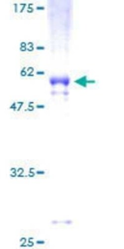 Novus Biologicals Recombinant Human VDAC2 GST (N-Term) Protein 25 &mu;g | Buy Online | Novus Biologicals&trade; | Fisher Scientific