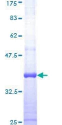 Novus Biologicals Recombinant Human VDR/NR1I1/Vitamin D Receptor GST (N-Term) Protein 25 &mu;g | Buy Online | Novus Biologicals&trade; | Fisher Scientific