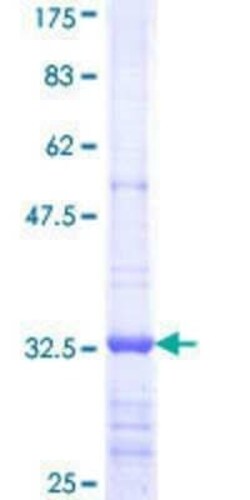 Novus Biologicals Recombinant Human Villin 1 GST (N-Term) Protein 10 &mu;g | Buy Online | Novus Biologicals&trade; | Fisher Scientific