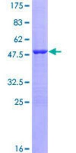 Novus Biologicals Recombinant Human VIP GST (N-Term) Protein 25 &mu;g | Buy Online | Novus Biologicals&trade; | Fisher Scientific