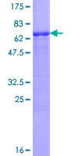 R&D Systems&trade;&nbsp;Recombinant Human VRK1 GST (N-Term) Protein