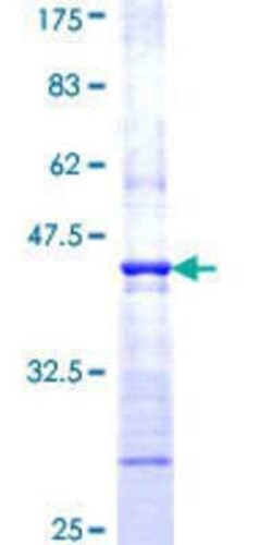 Novus Biologicals Recombinant Human WASP GST (N-Term) Protein 10 &mu;g | Buy Online | Novus Biologicals&trade; | Fisher Scientific