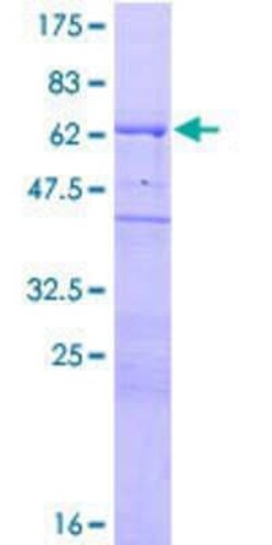 Novus Biologicals Recombinant Human WIPF1/WIP GST (N-Term) Protein 25 &mu;g | Buy Online | Novus Biologicals&trade; | Fisher Scientific
