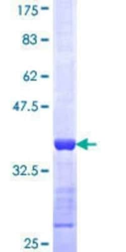 Novus Biologicals&trade;&nbsp;Recombinant Human CYLN2 GST (N-Term) Protein
