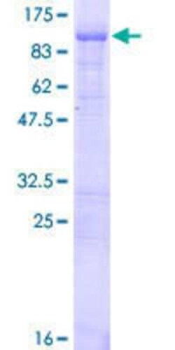 Novus Biologicals Recombinant Human Wee1 GST (N-Term) Protein 10 &mu;g | Buy Online | Novus Biologicals&trade; | Fisher Scientific