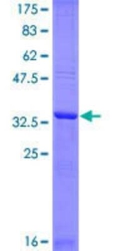 Novus Biologicals Recombinant Human Wee1 GST (N-Term) Protein 10 &mu;g | Buy Online | Novus Biologicals&trade; | Fisher Scientific