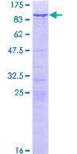 Novus Biologicals Recombinant Human WHSC1 GST (N-Term) Protein 10 &mu;g | Buy Online | Novus Biologicals&trade; | Fisher Scientific