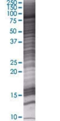 Novus Biologicals WHSC1 293T Cell Transient Overexpression Lysate 0.1 mL | Buy Online | Novus Biologicals&trade; | Fisher Scientific