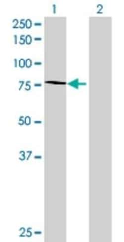 Novus Biologicals™ WHSC1 293T Cell Transient Overexpression Lysate