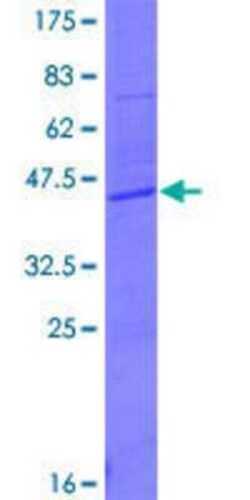Novus Biologicals Recombinant Human Tryptophan rich protein GST (N-Term) Protein 10 &mu;g | Buy Online | Novus Biologicals&trade; | Fisher Scientific