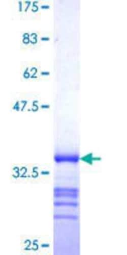 Novus Biologicals Recombinant Human Tryptophan rich protein GST (N-Term) Protein 25 &mu;g | Buy Online | Novus Biologicals&trade; | Fisher Scientific
