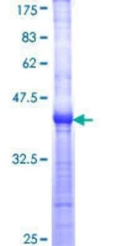 Novus Biologicals Recombinant Human WRN GST (N-Term) Protein 2 &mu;g | Buy Online | Novus Biologicals&trade; | Fisher Scientific