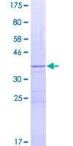 Novus Biologicals Recombinant Human Xanthine Oxidase GST (N-Term) Protein 2 &mu;g | Buy Online | Novus Biologicals&trade; | Fisher Scientific
