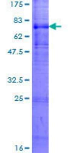 Novus Biologicals Recombinant Human XK X-linked Kx blood group GST (N-Term) Protein 2 &mu;g | Buy Online | Novus Biologicals&trade; | Fisher Scientific