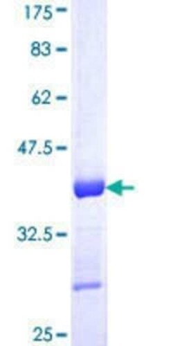 Novus Biologicals Recombinant Human XRCC1 GST (N-Term) Protein 25 &mu;g | Buy Online | Novus Biologicals&trade; | Fisher Scientific