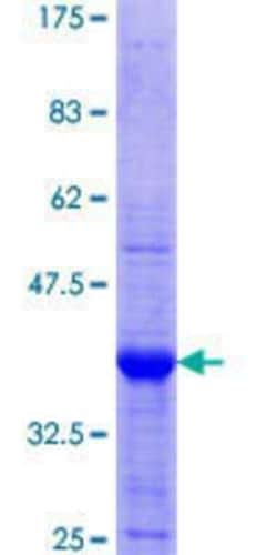 Novus Biologicals Recombinant Human XRCC4 GST (N-Term) Protein 10 &mu;g | Buy Online | Novus Biologicals&trade; | Fisher Scientific