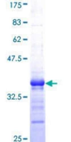 Novus Biologicals Recombinant Human Yes GST (N-Term) Protein 10 &mu;g | Buy Online | Novus Biologicals&trade; | Fisher Scientific