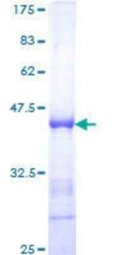 Novus Biologicals Recombinant Human Splicing Factor 1 GST (N-Term) Protein 10 &mu;g | Buy Online | Novus Biologicals&trade; | Fisher Scientific