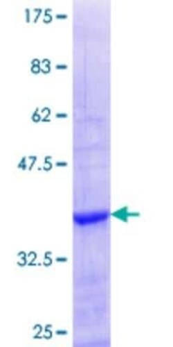 Novus Biologicals Recombinant Human ZFP37 GST (N-Term) Protein 25 &mu;g | Buy Online | Novus Biologicals&trade; | Fisher Scientific