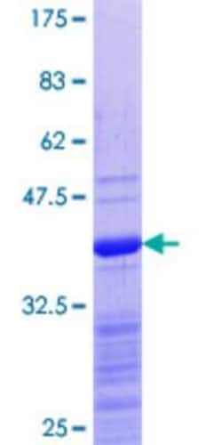 Novus Biologicals Recombinant Human ZBTB14 GST (N-Term) Protein 10 &mu;g | Buy Online | Novus Biologicals&trade; | Fisher Scientific