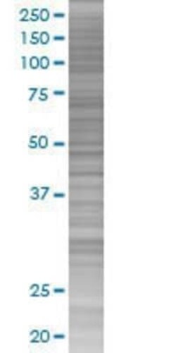 Novus Biologicals ZBTB14 293T Cell Transient Overexpression Lysate 0.1 mL | Buy Online | Novus Biologicals&trade; | Fisher Scientific