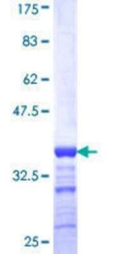 Novus Biologicals Recombinant Human ZIC1 GST (N-Term) Protein 10 &mu;g | Buy Online | Novus Biologicals&trade; | Fisher Scientific