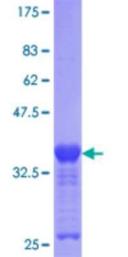 Novus Biologicals Recombinant Human ZIC3 GST (N-Term) Protein 2 &mu;g | Buy Online | Novus Biologicals&trade; | Fisher Scientific