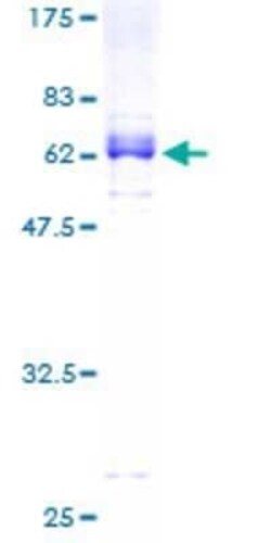Novus Biologicals Recombinant Human ZNF2 GST (N-Term) Protein 10 &mu;g | Buy Online | Novus Biologicals&trade; | Fisher Scientific