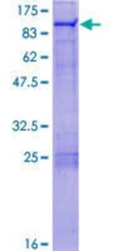 Novus Biologicals Recombinant Human ZNF7 GST (N-Term) Protein 25 &mu;g | Buy Online | Novus Biologicals&trade; | Fisher Scientific