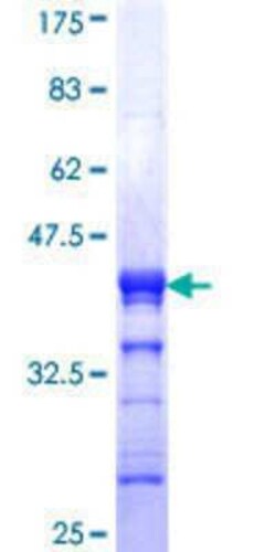 Novus Biologicals Recombinant Human ZNF7 GST (N-Term) Protein 25 &mu;g | Buy Online | Novus Biologicals&trade; | Fisher Scientific