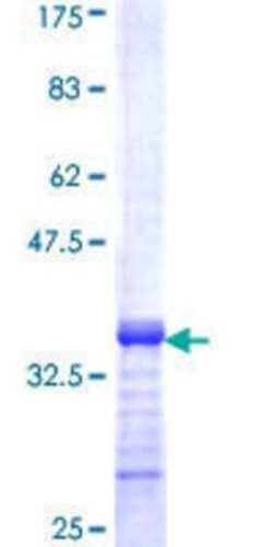 Novus Biologicals Recombinant Human ZNF14 GST (N-Term) Protein 10 &mu;g | Buy Online | Novus Biologicals&trade; | Fisher Scientific