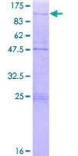 Novus Biologicals Recombinant Human ZNF16 GST (N-Term) Protein 2 &mu;g | Buy Online | Novus Biologicals&trade; | Fisher Scientific