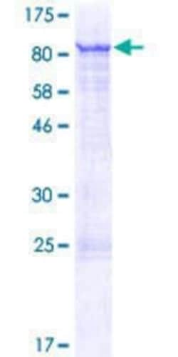 Novus Biologicals Recombinant Human ZNF18 GST (N-Term) Protein 10 &mu;g | Buy Online | Novus Biologicals&trade; | Fisher Scientific