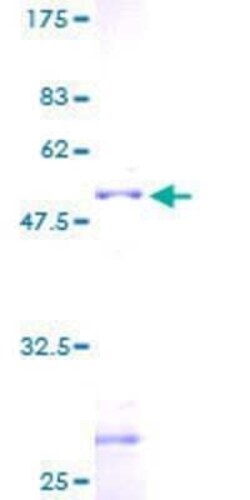 Novus Biologicals Recombinant Human ZNF22 GST (N-Term) Protein 2 &mu;g | Buy Online | Novus Biologicals&trade; | Fisher Scientific