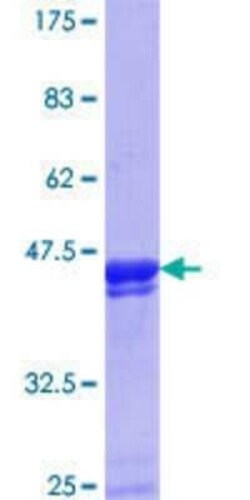 Novus Biologicals Recombinant Human ZNF23 GST (N-Term) Protein 10 &mu;g | Buy Online | Novus Biologicals&trade; | Fisher Scientific