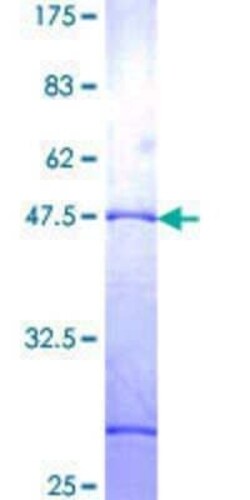 Novus Biologicals Recombinant Human ZNF26 GST (N-Term) Protein 10 &mu;g | Buy Online | Novus Biologicals&trade; | Fisher Scientific