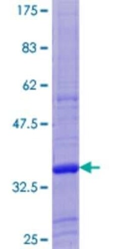 Novus Biologicals Recombinant Human ZNF28 GST (N-Term) Protein 10 &mu;g | Buy Online | Novus Biologicals&trade; | Fisher Scientific