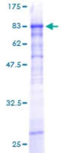 Novus Biologicals&trade;&nbsp;Recombinant Human ZNF31 GST (N-Term) Protein